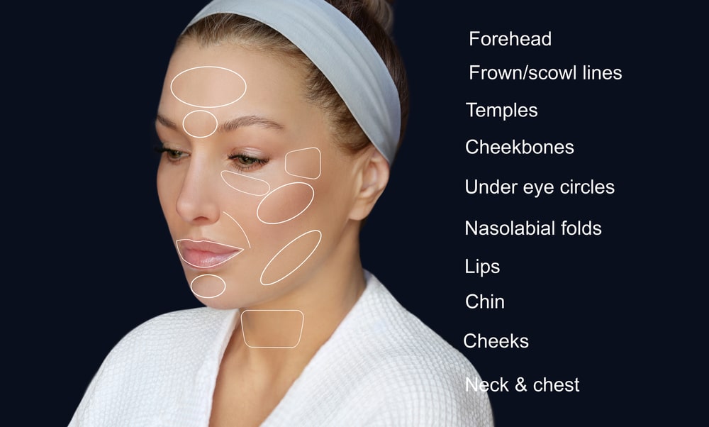 dysport vs botox