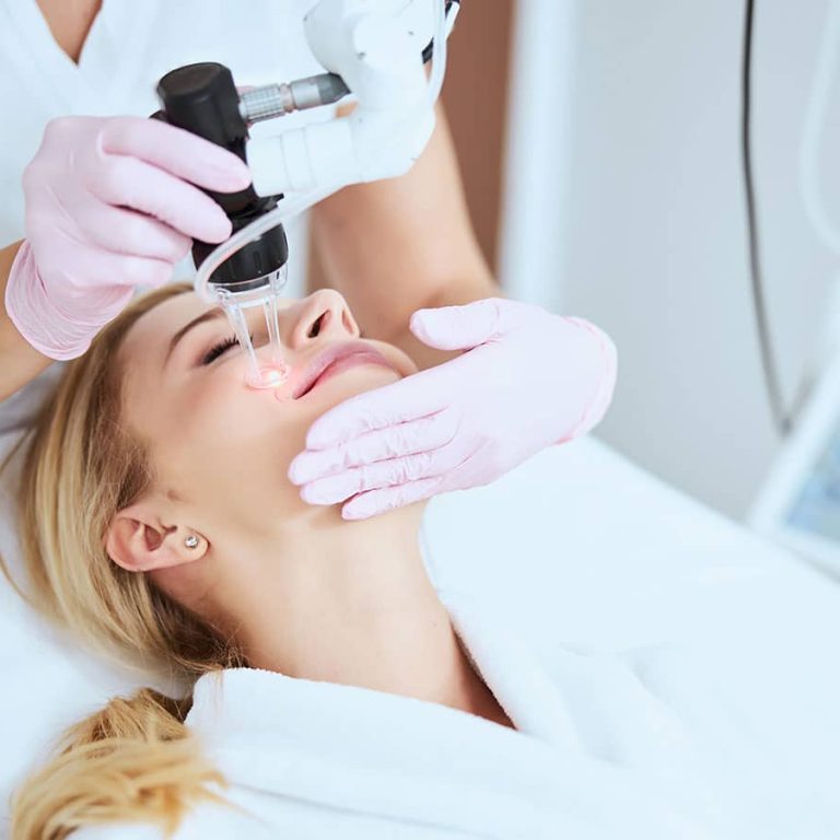 Laser Skin Rejuvenation (1)