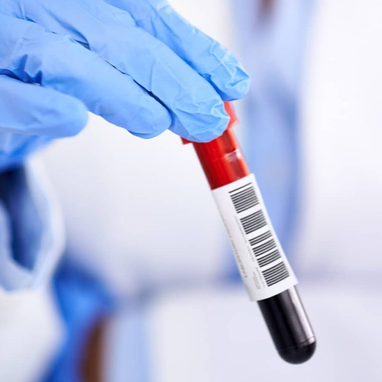 Testing & Diagnosis (1)